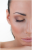 Epilase Laser Hair and Skin Clinic - Image 3